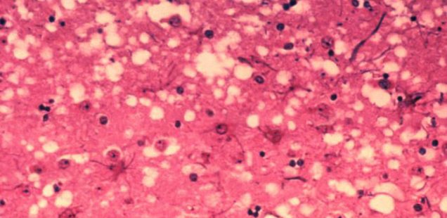 Prions : Des différences d’activité selon les cellules infectées