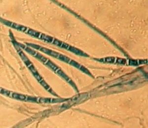 Microbiote et contaminants alimentaires : une mycotoxine amplifie l’action génotoxique d’une bactérie intestinale