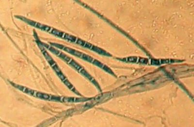 Microbiote et contaminants alimentaires : une mycotoxine amplifie l’action génotoxique d’une bactérie intestinale