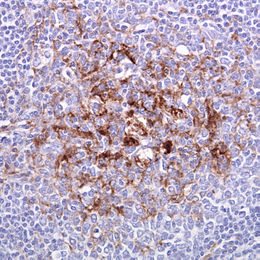 L’Inra réagit au décès d’une chercheuse, due à la maladie Creutzfeldt-Jakob